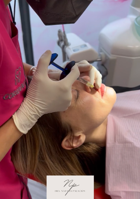 Consulta Aumento Labios