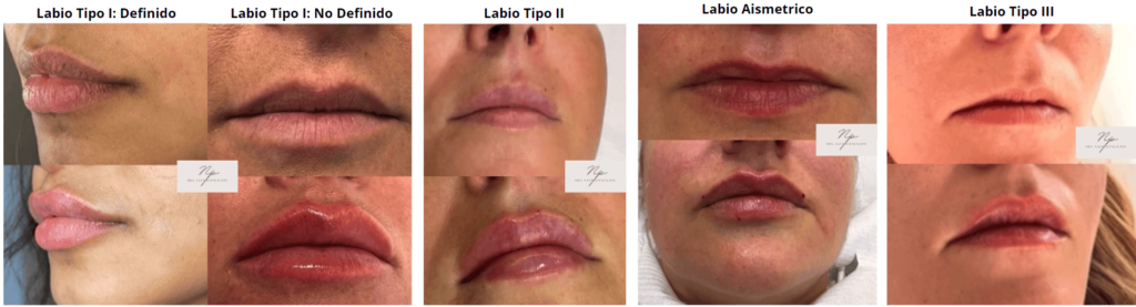 Tipos de Labios