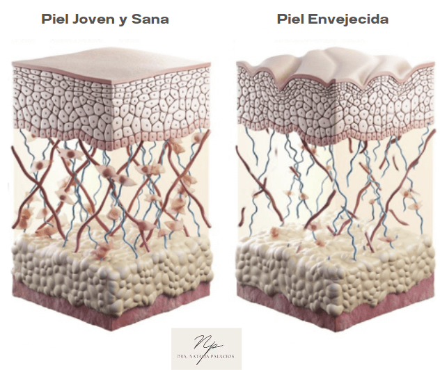 Comparación Piel Joven y Piel Envejecida